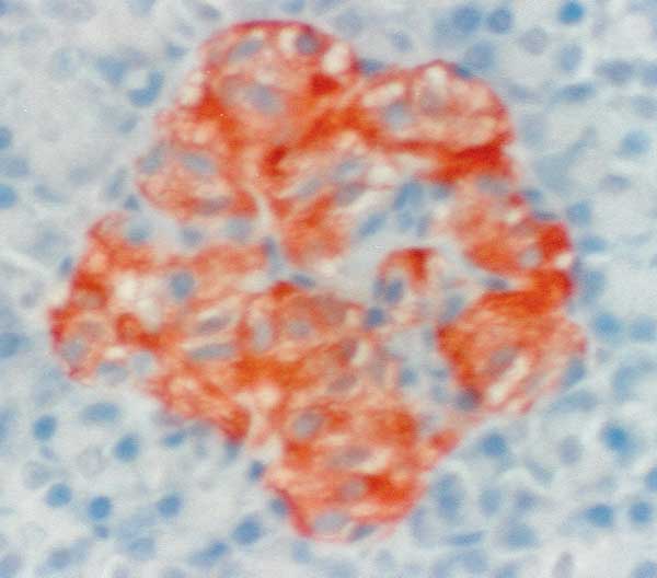 The pancreatic islet of a healthy control cat is shown for comparison