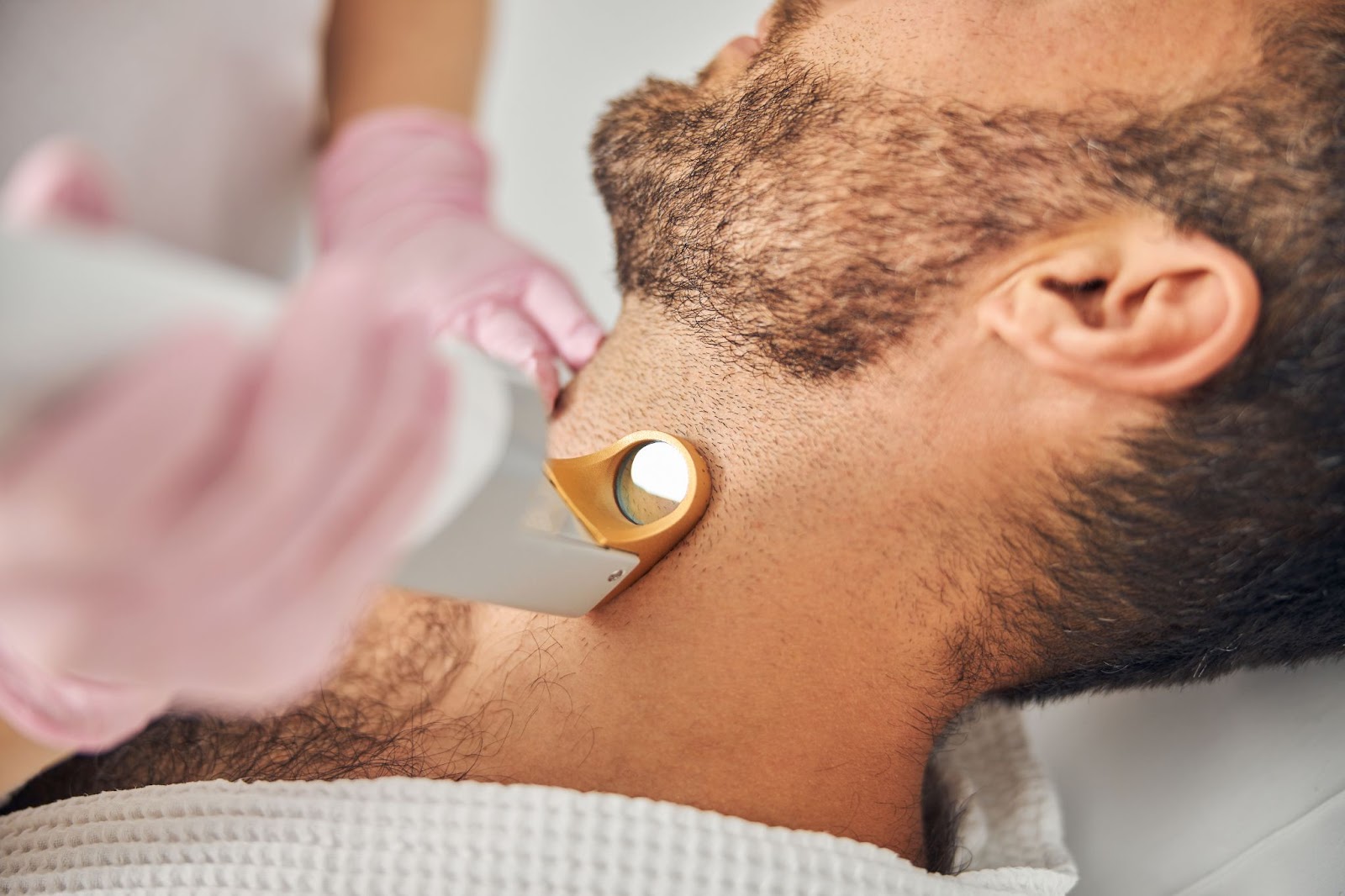 Image of a male having laser hair removal for beard