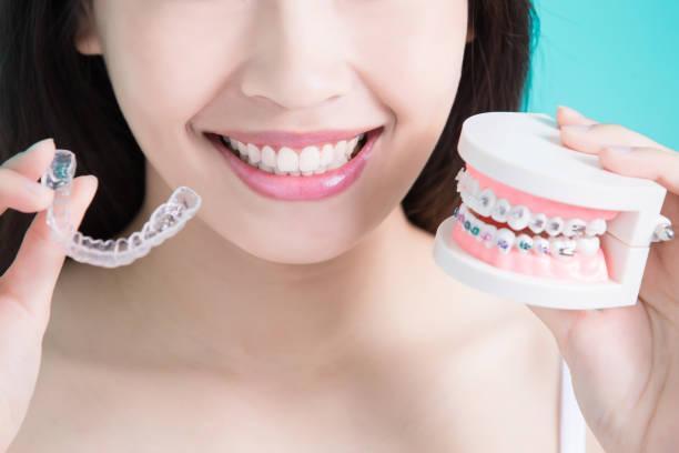 healthy dental concept woman choicce different brace on green background invisalign oral health stock pictures, royalty-free photos & images
