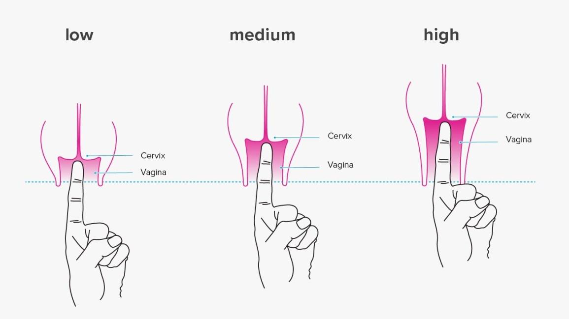 Cách xác định chiều dài âm đạo vào cổ tử cung thấp, trung bình, cao chỉ bằng cách sử dụng ngón tay trỏ để đo