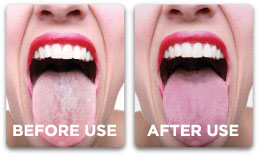 Proper Tongue Hygiene 3