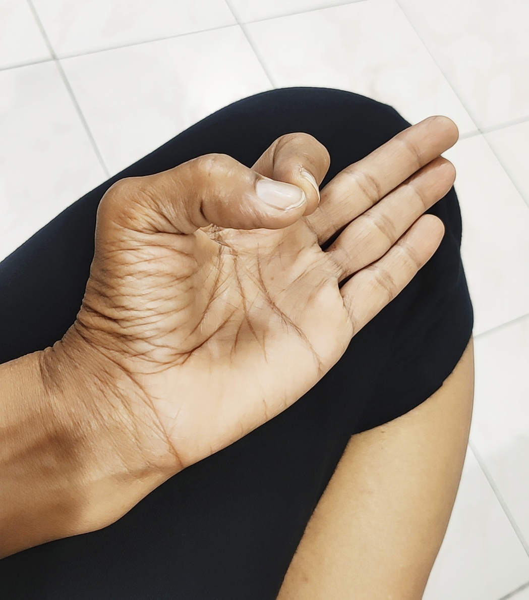 Place The left hand in 'Chin Mudra" as shown here to practice  Alternate Nostril Breathing (Anulom - Vilom Pranayama). This pranayama is highly recommended for lung health and for former smokers. 