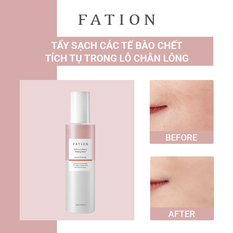 toner - Nước hoa, mỹ phẩm: Nước hoa hồng tẩy tế bào chết FATION NoSCalm Repair Peeling T 4q2w0NvL7A4o97wkJKevXAfF8bt29ox6m0_mzbwJTm571ok_VmkZyErxNXDn_gyaQgGJPmpEw__x4IoGe2h590j_1LkHVZP_n6nnTrl6KL-AM_YINPT4pHb493MfIv5QpgtRhhw3