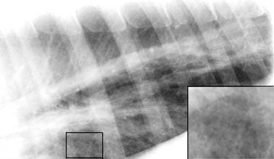A right lateral radiograph of the dorsal caudal thorax of a horse with recurrent airway obstruction. Diffuse loss of detail is due to an unstructured interstitial pattern probably due to summation and geometric distortion of changes in the respiratory level of the lung. The diaphragm is concave. Some small airway wall thickening (structured bronchiolar interstitial change) is present. Radiographic findings are much like those in other interstitial diseases (see Fig. 4).