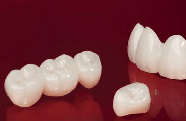 răng sứ Ceramill