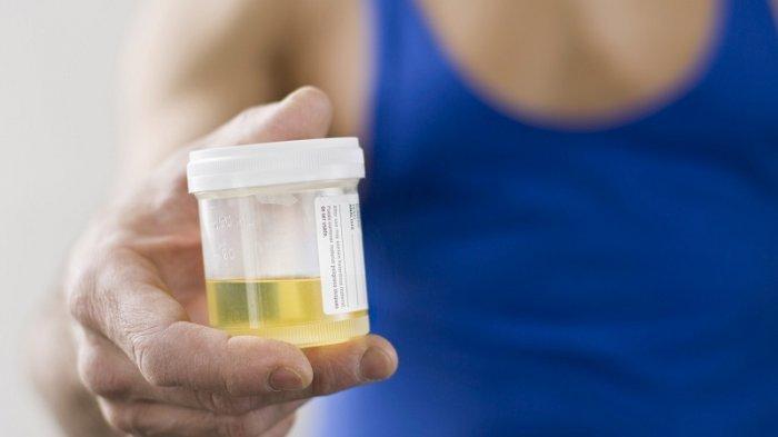 2. Mitos VS Fakta Vitamin C - Bikin Urin Berwarna Kuning