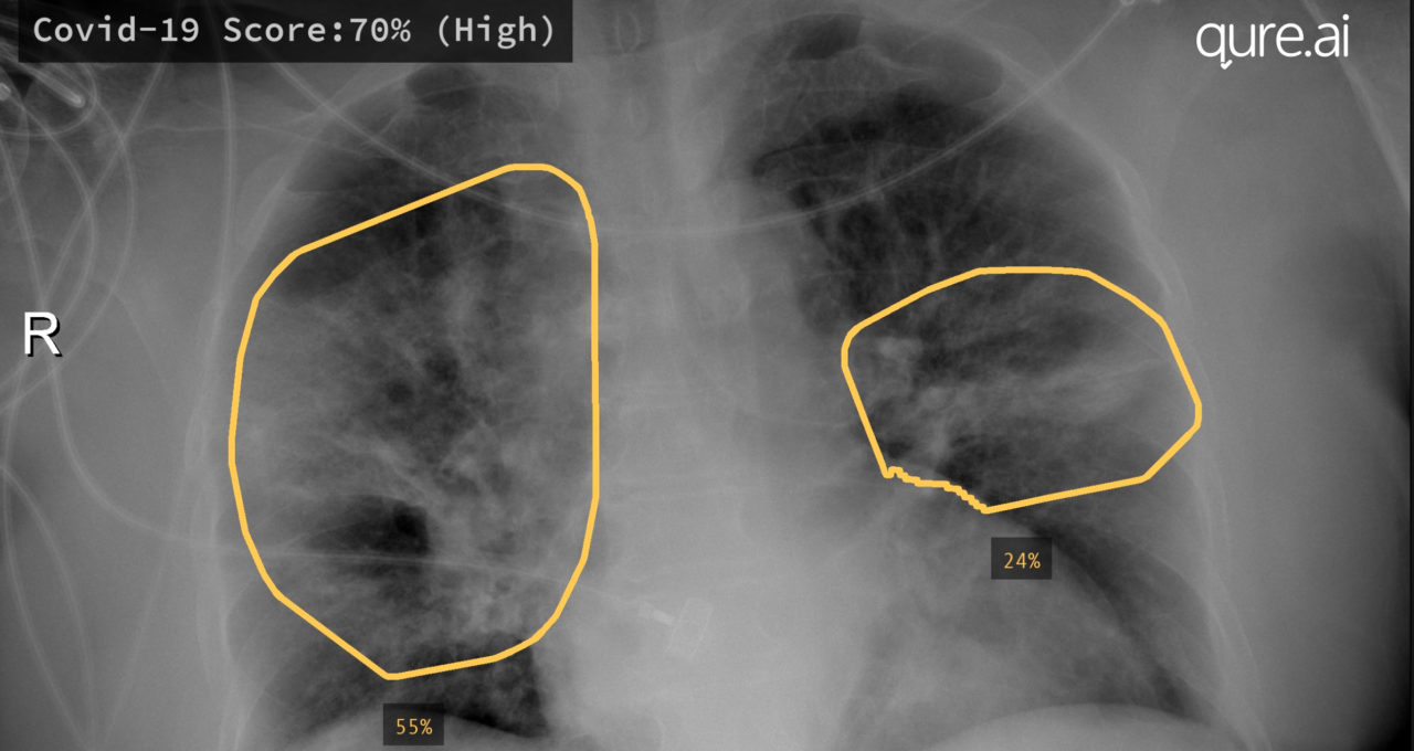 Artificial intelligence in medicine