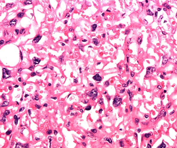 High magnification of labyrinthine placental portion