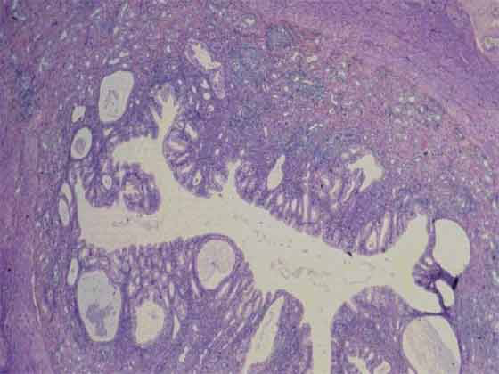 Гистологическая картина матки собаки во время первого этапа диеструса (метэструс) в начале лютеальной фазы