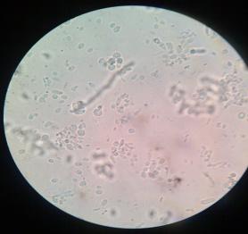 F:\GAMBAR percobaan 7\gambar kol\15% asli rhodosporidium kratochvilovae.jpg