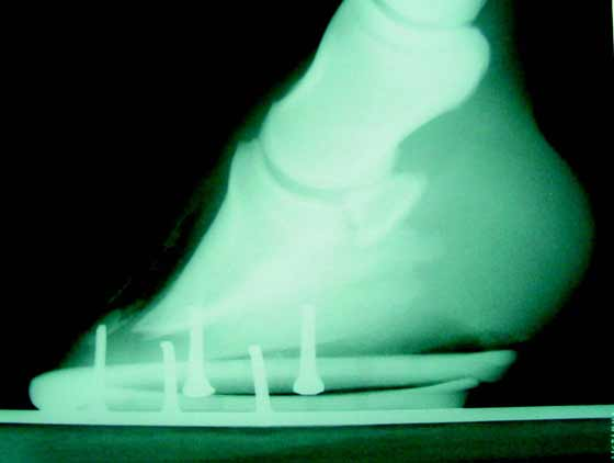Radiograph showing the separation extending up the dorsal hoof wall. Note the clubfoot conformation of the foot. 