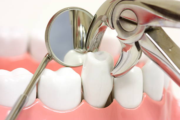 Dental Implant Courses in India