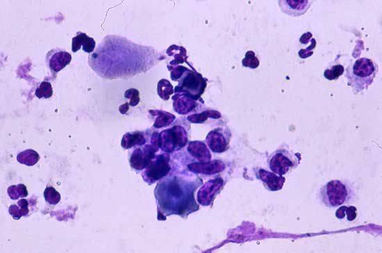 Vaginal smear obtained from a bitch at 4 days after the onset of metestrus