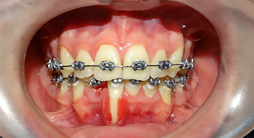 Ortodoncia - Dental Concept