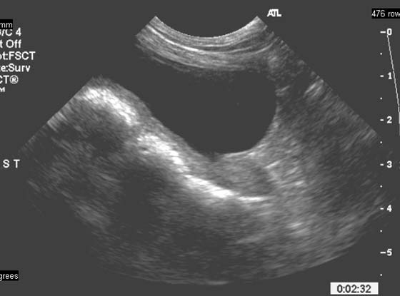 Sonogram a normal prostate of a middle age neutered dog with an incidentally observed atypical orientation of the bladder