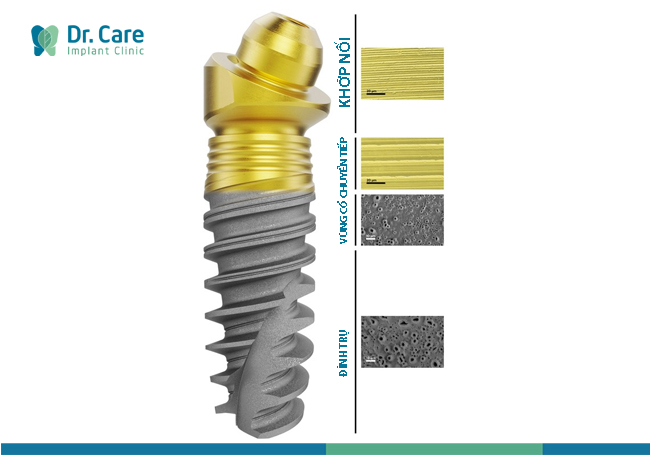  Top 3 dòng trụ Implant Mỹ được ưa chuộng nhất hiện nay