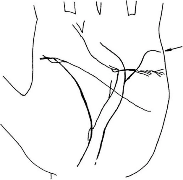 https://lh4.googleusercontent.com/U8RiPL0N8TLsguKS6CZ7XxQh80K881-r8fvLSMysqaMu0WHP_pwYAGCYus8UNIOK23KYOiVvHoWezHLQ76EvfXs3ol1VLounIxqjBJLfVCrBwk9Lu8ZHkz2GguvXwMIYbJMvFwfhNTGOuZUvmERfmDKwOj7Zrgh6aE8RpWRz9qDBq3_wdX8dMGWbsDDBUnKAwrj5NUtTuQ