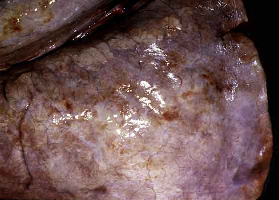 Chronic interstitial pneumonia associated with Rhodococcus equi infection. The affected areas of lung are firm, swollen and pale. 
