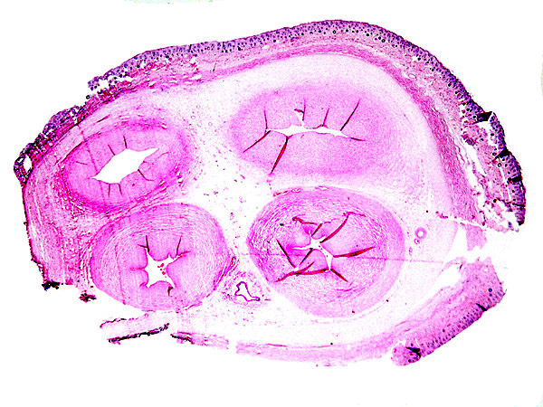 Term cord near abdominal surface, with partial cover of fetal skin (above) and allantoic duct (below, center).