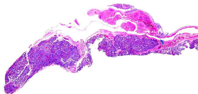 Another cross section of the aye-aye placenta