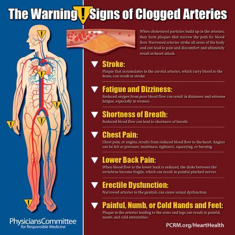 cholesterol and heart disease