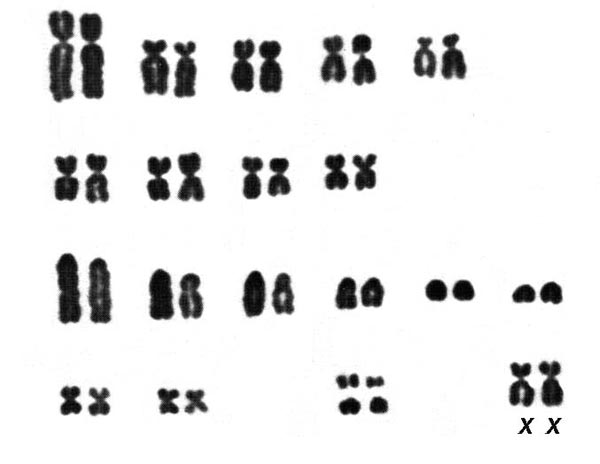 Karyotypes of female domestic pigs, 2n=38