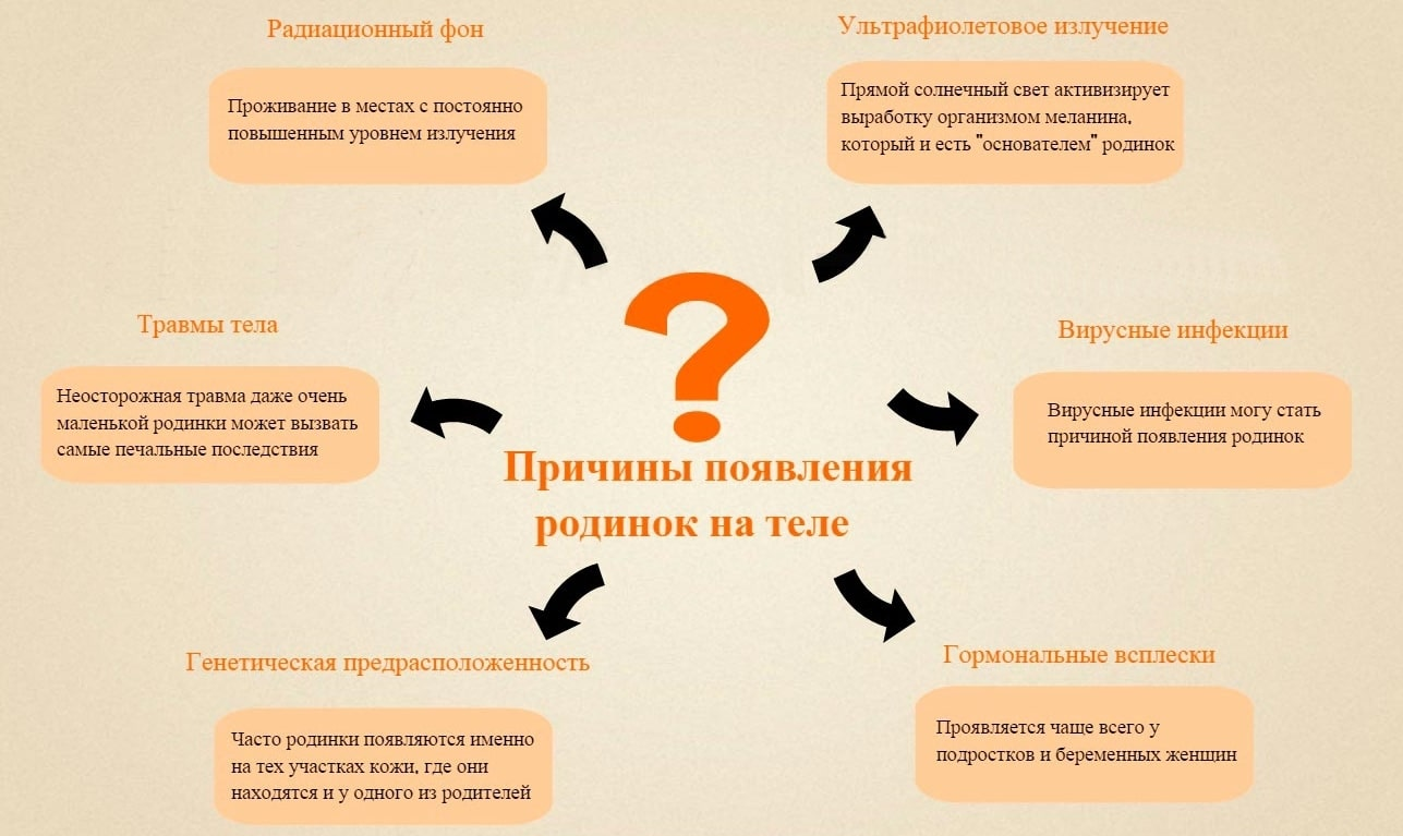 Почему появляются т. Причины появления родинок. Почему появляются родинки. Причины появления новых родинок. Причины возникновения родинок.