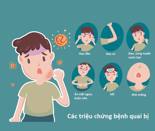 Triệu chứng thường gặp của bệnh quai bị