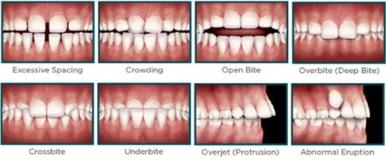 We Offer Orthodontics For Children | Norwest Orthodontics