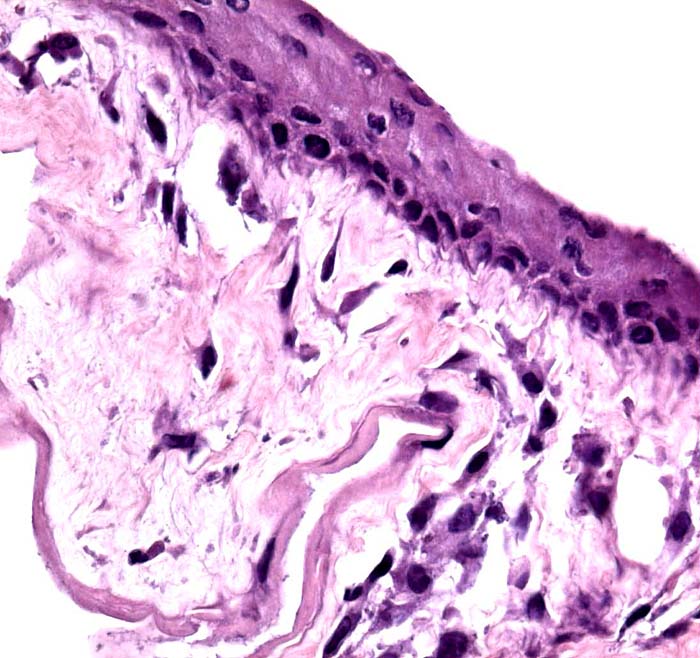 The cord's surface has squamous epithelium