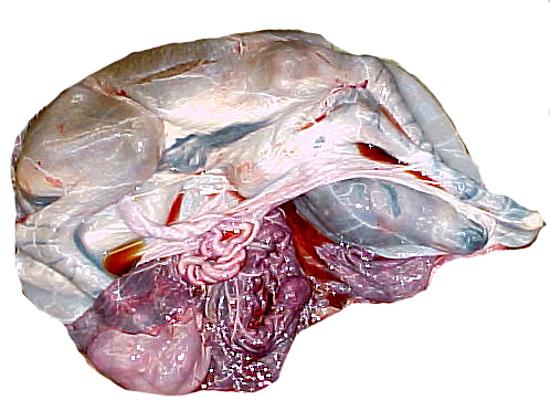Near-term fetus still within its amnionic sac. The vessels of the allantoic portion of the umbilical cord protrude and ramify over the allantoic surface