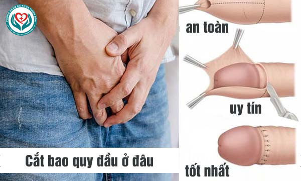 cắt bao quy đầu ở đâu an toàn