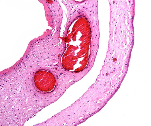 At left is the amnionic membrane, at left is the vascularized allantoic membrane with its cylindrical epithelium