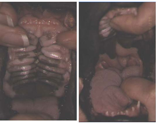 An eight week old Boston Terrier pup with clefts of the hard palate and agenesis of the left side of the soft palate.