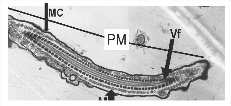 Fotomicrografía electrónica de transmisión. Pieza media (PM) o parte principal. Membrana celular (MC) electrodensa, mitocondrias (M) y vaina fibrosa (Vf). Técnica de contraste de uranilo y citrato de plomo. Aumento 7 000X.