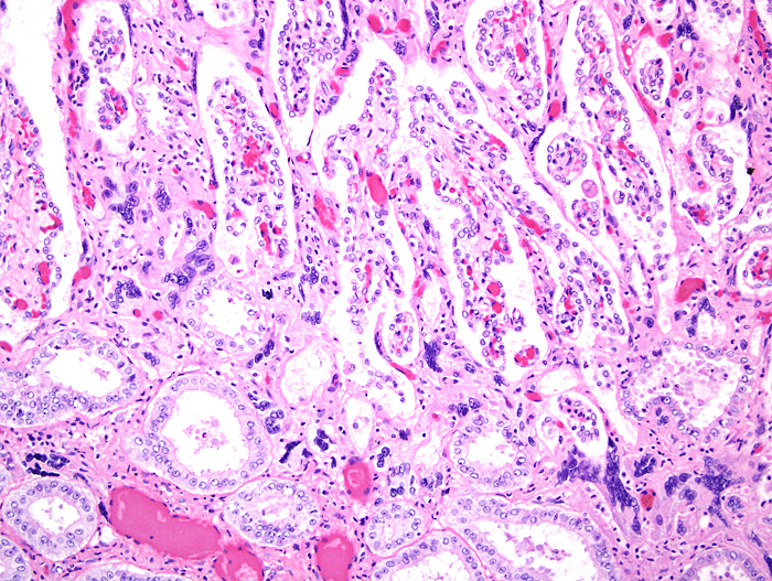 Placental implantation site with endometrial glands at bottom and dark blue syncytiotrophoblast at the interface.