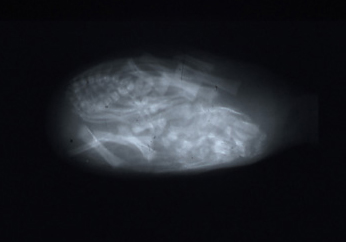 Radiograph of fetal mummy (Fig. 9) showing bones present within the mummified fetal remnant.