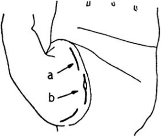 https://lh4.googleusercontent.com/8HZqqfpb8NPm-RVpYf-bcwF8C5jU68vtFXXUq-huTd2ROdAWEWpWbo6yWpBS1yjKqGkUj6bWfL9ohmXSZ9LvpFxoVRT-AYi34htMq3Yl-cWxyBFf3pahGr5LsiZdco5e0ORrwD0bQ25qxK1gKcy11NhAd2GCxtsZfH8lD-dfII0p7hShBSpGJRb0ctLDkhtwRE8YGof4Bw