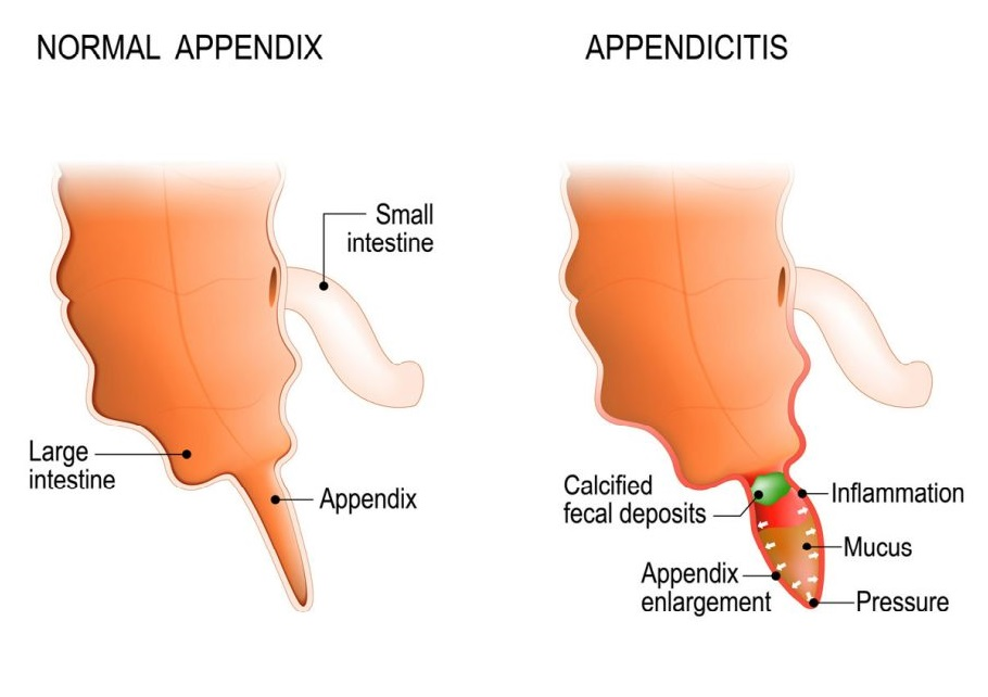 Appendix