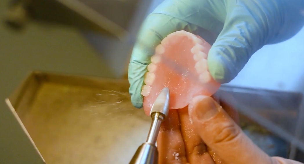 Denture Fabrication - Finishing