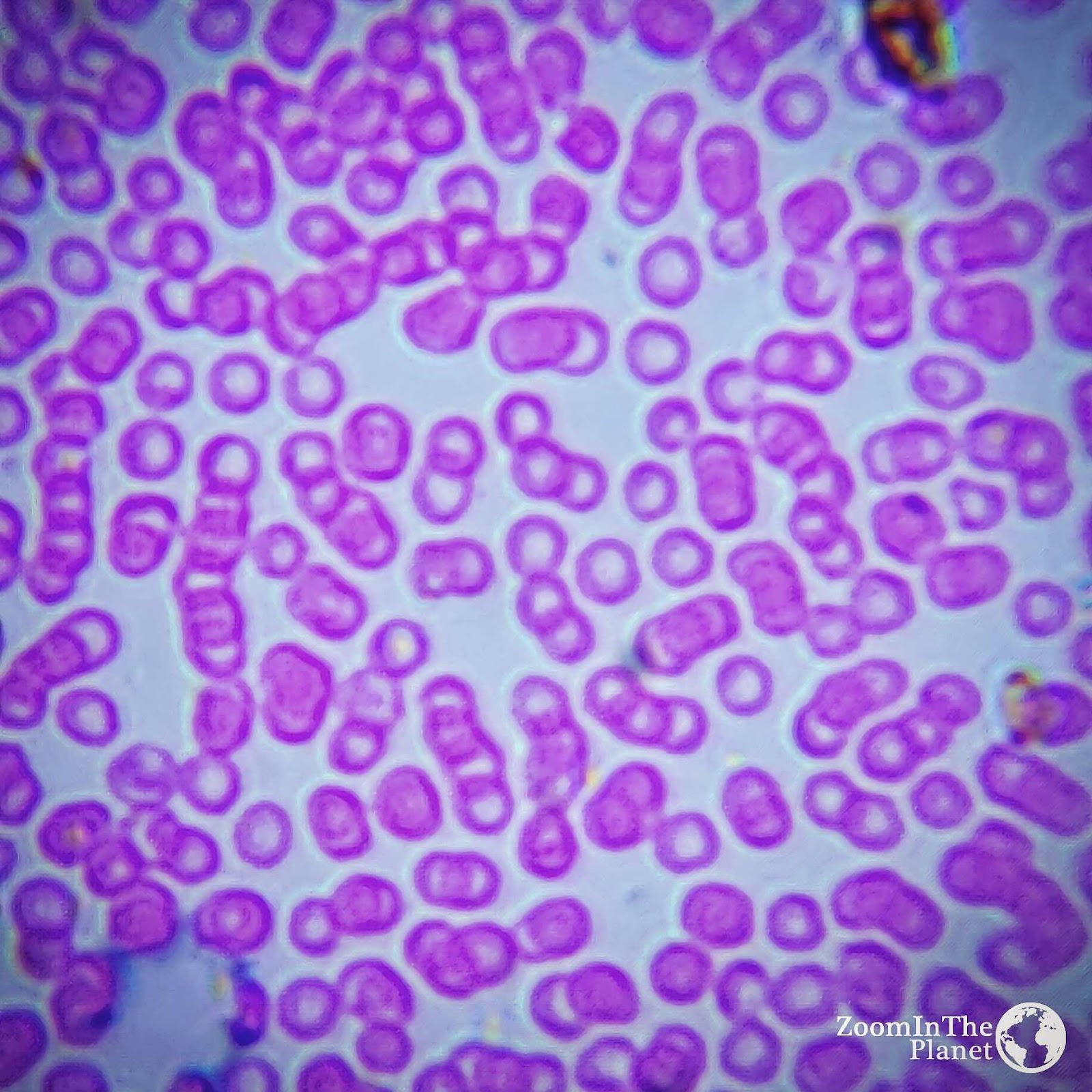 BLOOD