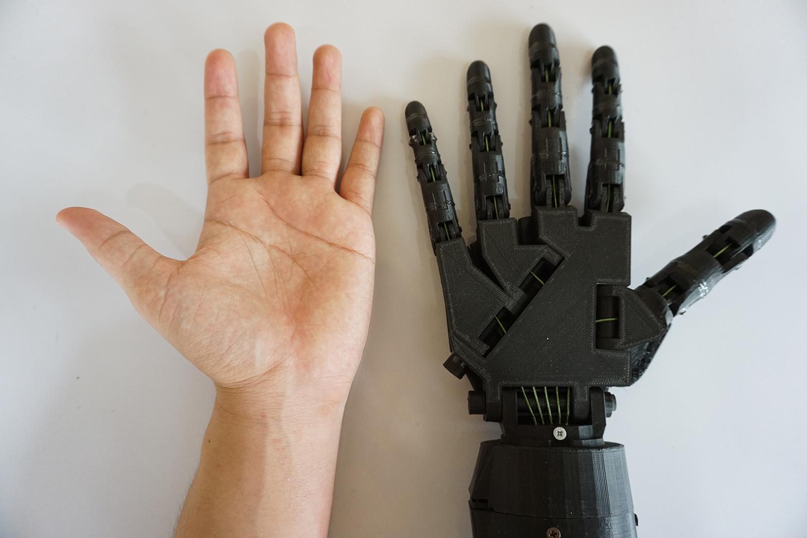 3d printed prosthetic limb