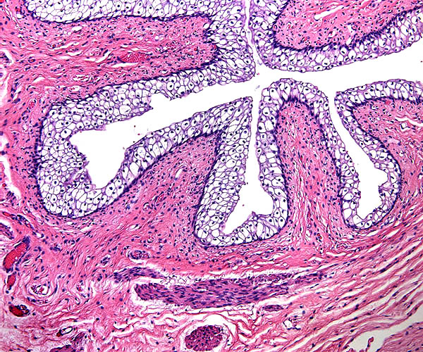 This is the allantoic duct within the umbilical cord. Its lining is a multi-layered transitional epithelium, similar to that of the urinary bladder