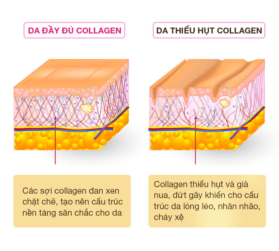 Collagen biến đổi như thế nào?