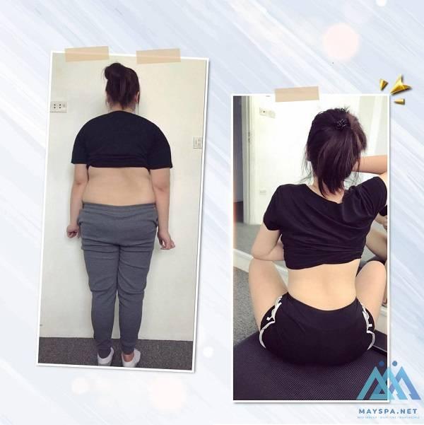 cong-nghe-giam-beo-sculpsure-4-mtmi