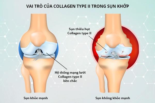 Collagen có vai trò quan trọng với xương khớp