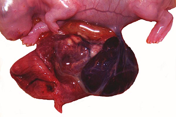 Dark placental disk, short umbilical cord