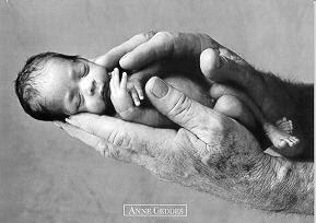 Image result for a real tiny low birth weight African American baby