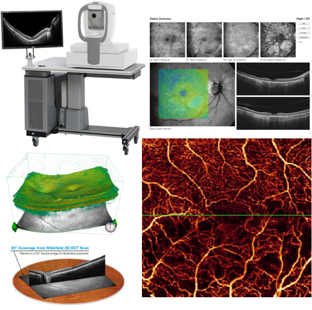 視網膜血管斷層掃描儀(Angio-OCT)