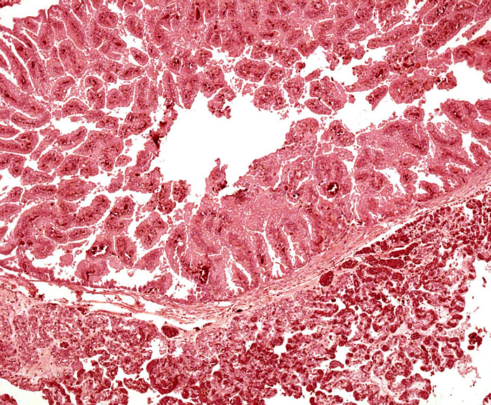 Higher magnification of the areolar “chorionic vesicle” and adjacent villi.